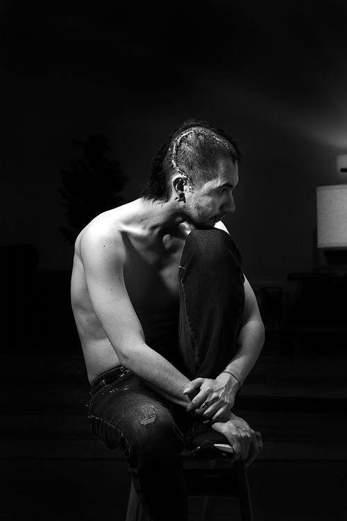 Black and white Portrait Oman with cranial scar.